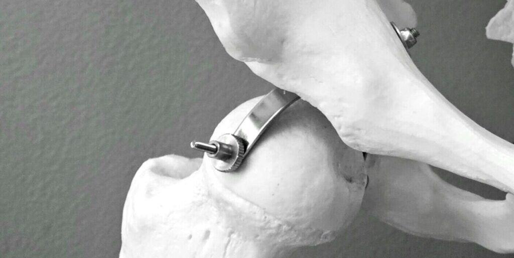 Hip Replacement Domain Name